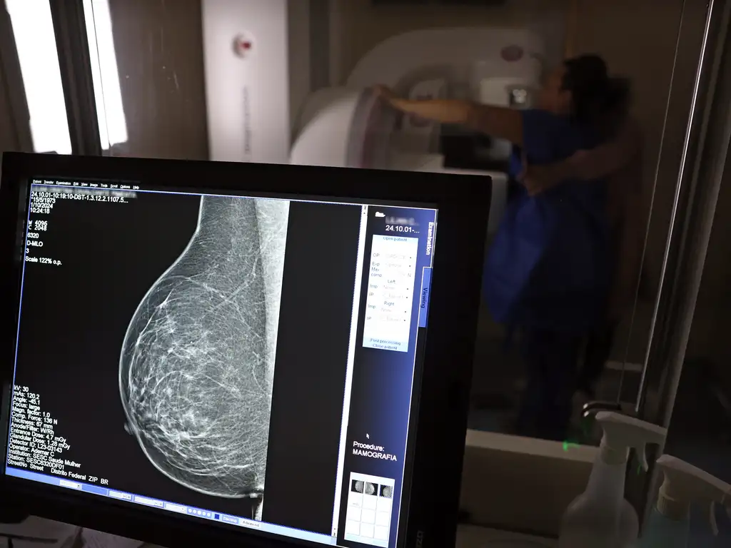 Cirurgias plásticas de mama no SUS crescem 54% em dez anos